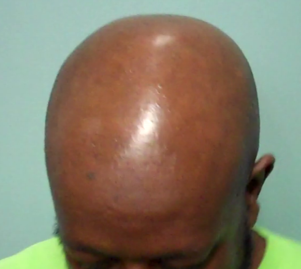 Shiny bald head: How to add or eliminate the shine? [2023] – Skull
