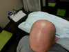 Are Shiny Scalps Linked to Skin Type?