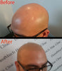 Beat Scalp Shine on the Road: Travel Essential Every Bald Head Needs