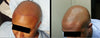 The Scalp Shine That Shows Up at the Worst Moments