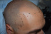 Why Matte Makeup Doesn't Work Long-Term on A Bald Scalp?