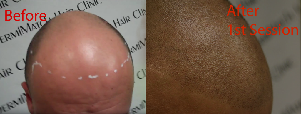 Mastering the Micropigmentation: Why Practice Heads are Vital