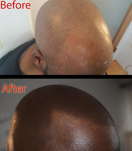 Is shiny scalp bad?