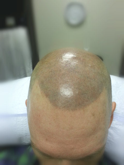 Why Bald Heads Are Often Shiny?