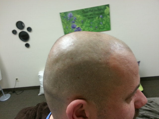 Shiny Scalp vs Healthy Glow - Know the Difference