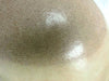 Why Does My Scalp Shine So Much: How to Fix It Without Damaging My Skin?