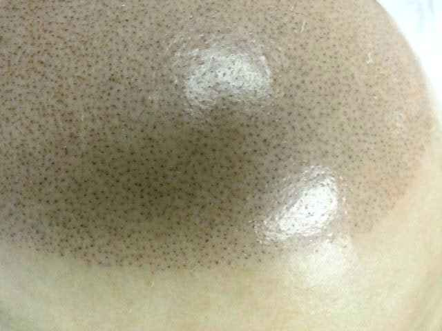 What To Do When Your Scalp Looks Too Oily in Photos?