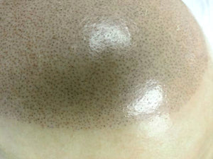 What To Do When Your Scalp Looks Too Oily in Photos?