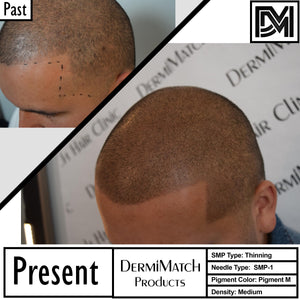 What Happens If You Sweat After Scalp Micropigmentation?