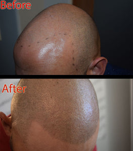 SMP Aftercare: How to Fix Your Shiny Head Problem
