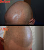 SMP Aftercare: How to Fix Your Shiny Head Problem
