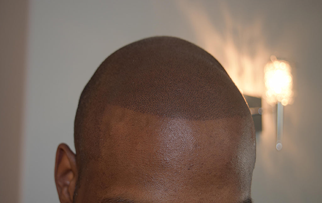 How to Banish Scalp Glare and Achieve a Natural Matte Finish