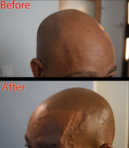 How to remove shine from a bald head?