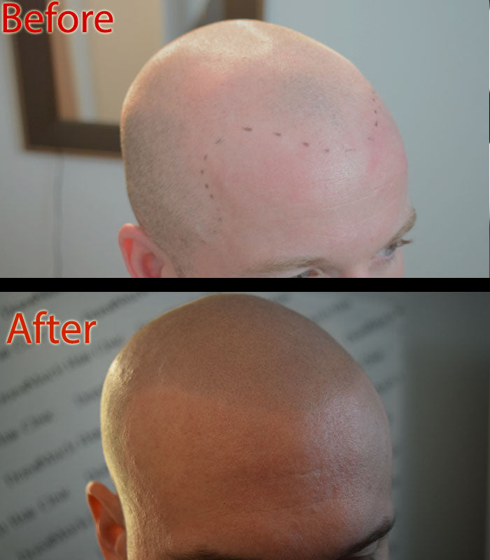 Is There a Natural Mattifying Product for Scalp?