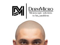 The Complete DermMicro Kit (HD) + Practice Head: For Scalp Micropigmentation Professionals