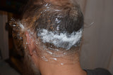 Example of scalp numbing cream for SMP pigmentation of scar