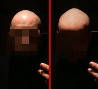 Shine remover for scalp micropigmentation smp. shiny removal for oily skin