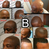 scalp micropigmentation pigments