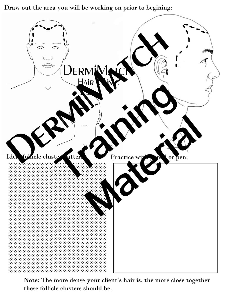 The DermMicro HD Pen - For Scalp Micropigmentation Professionals ...